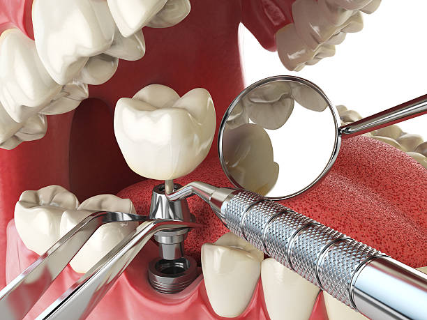 Professional Emergency Dentist in MA