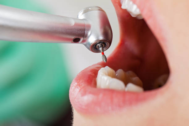 Best Emergency Dental Care for Trauma or Injury in Woods Hole, MA